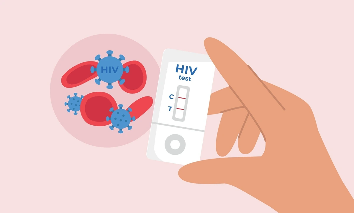 HIV چطور به ایدز تبدیل می‌ شود