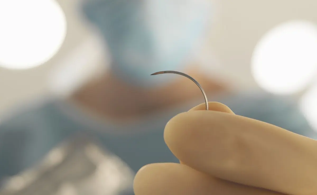 بخیه بعد از زایمان طبیعی چقدر طول می‌ کشد تا خوب شود؟