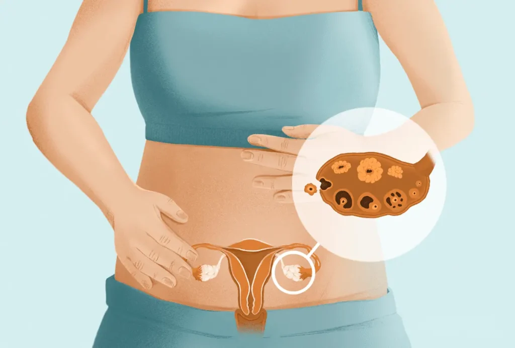 درد تخمک گذاری چند روز طول می کشد؟