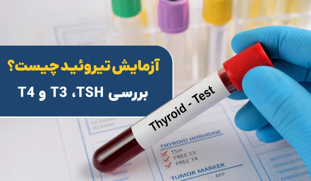 آزمایش تیروئید چیست؟ بررسی TSH، T3 و T4